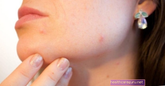 Kožní alergie: hlavní příčiny a způsob léčby