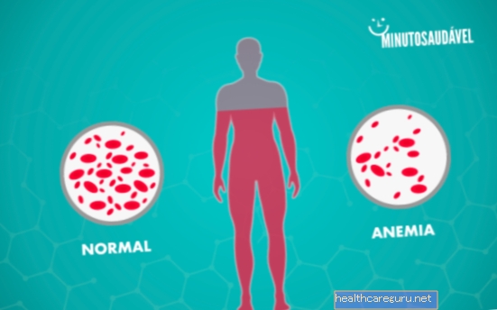 Cum se știe dacă este anemie: simptome și diagnostic