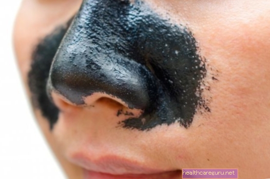 5 шагов по удалению черных точек в носу