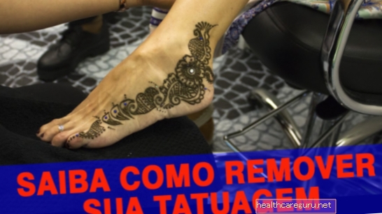 Come rimuovere un tatuaggio permanente o all'henné