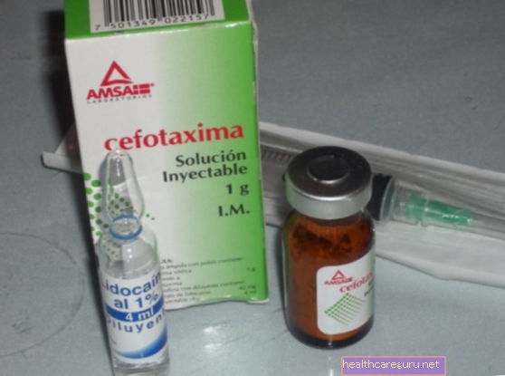 Цефотаксим - это лекарство для инъекций, известное как кальфоран. Это антибактериальное лекарство, которое устраняет бактерии из организма и очень эффективно лечит симптомы гонореи, менингита и инфекций.