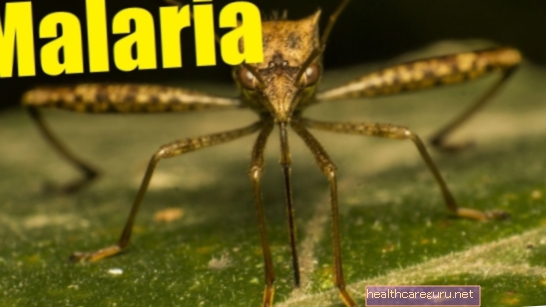 マラリアの8つの最初の症状