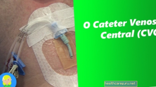 Centralni venski kateter (CVC): kaj je, za kaj služi in nega