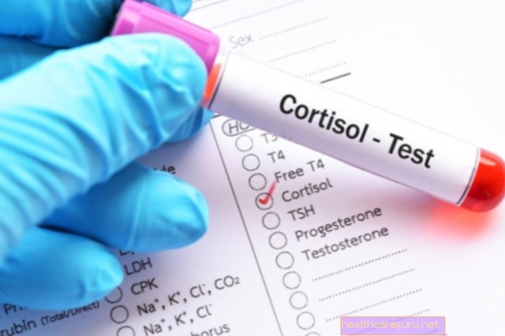 Hoge cortisol: wat het kan zijn, symptomen en hoe te downloaden