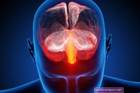التهاب الدماغ الفيروسي: ما هو وأهم الأعراض والعلاج