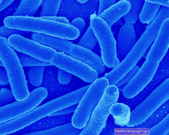 Lactobacillus acidophilus: mihin sitä käytetään ja miten se otetaan