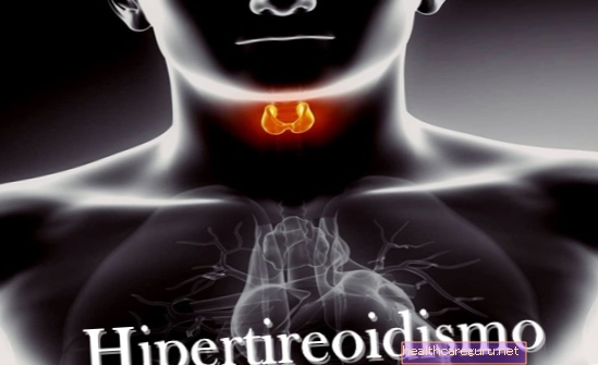 Ce este hipertiroidismul subclinic, cauze, diagnostic și tratament