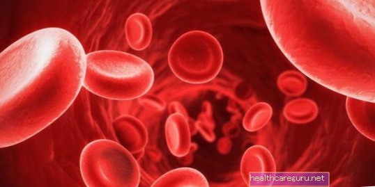 적혈구 증가증이란 무엇이며 원인, 식별 및 치료 방법