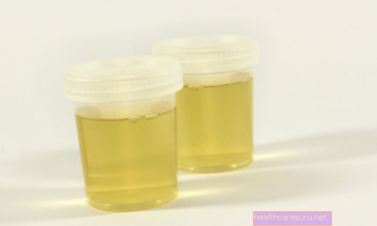 Hvad betyder positive ketonlegemer i urinen
