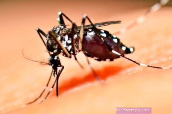 Kemungkinan komplikasi disebabkan oleh virus Zika