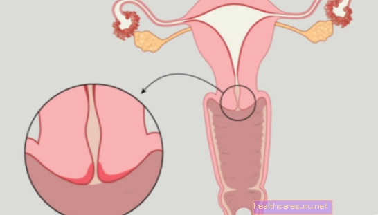 Lav uterus: Hvad det er, årsager og symptomer