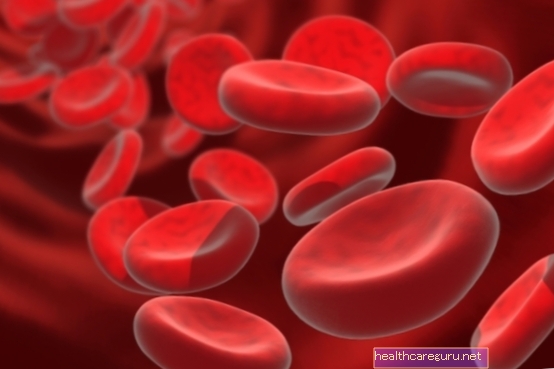 Anemia hemolitik: apa itu, gejala dan rawatan utama