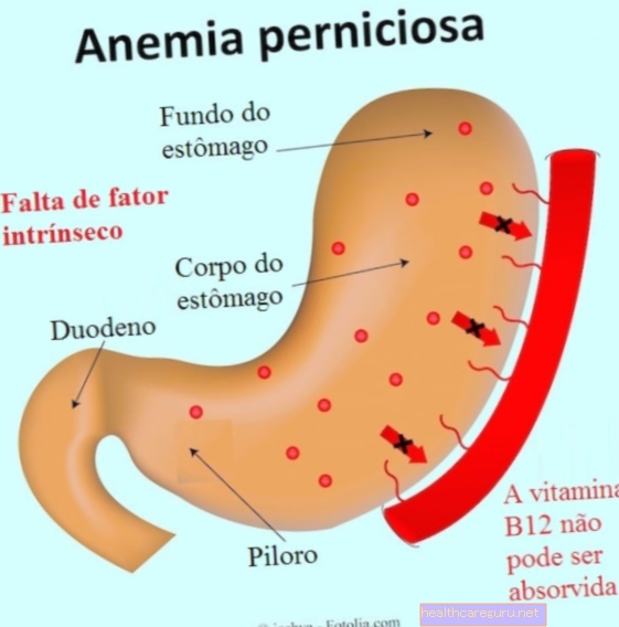 Pernicious anemia: oireet, diagnoosi ja hoito