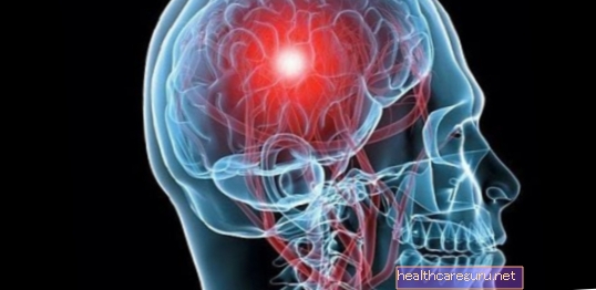 Cerebral blödning: symtom, orsaker och eventuella följder