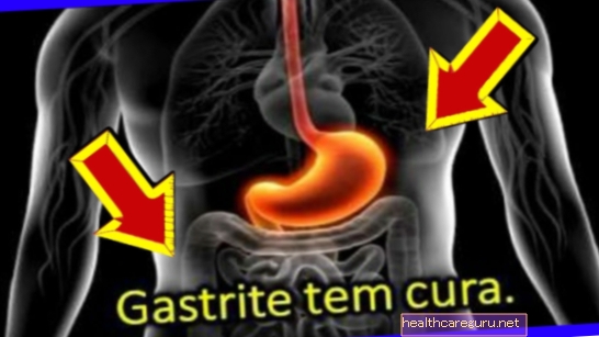 Apakah gastritis dapat disembuhkan?