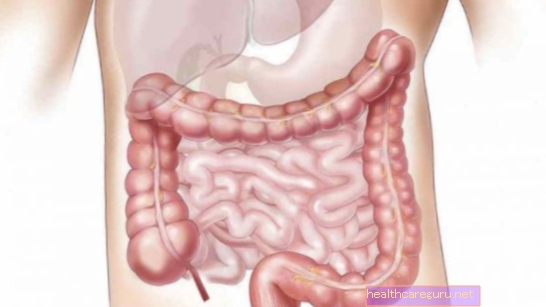 Problèmes Gastro Intestinaux,