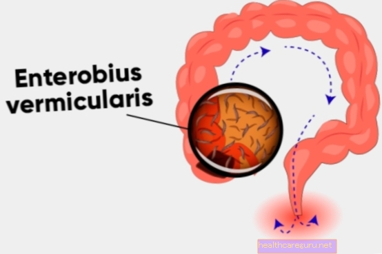 Oxyuriasis: nedir, semptomlar, bulaşma ve tedavi