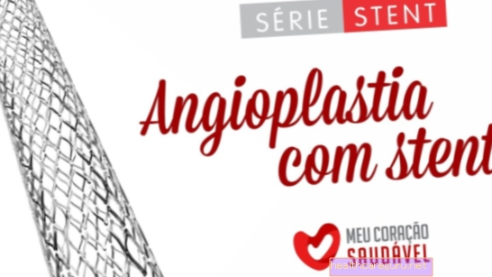 Stentangioplastik: hvad det er, risici og hvordan det gøres