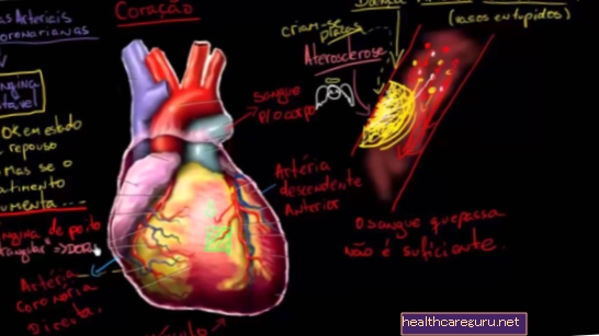 Ишемична болест на сърцето: какво е това, симптоми и лечение