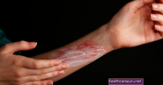 علاج أمراض الجلد