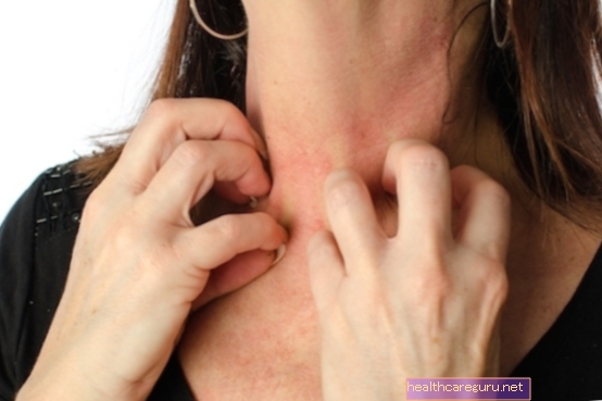 Kaj povzroča atopijski dermatitis