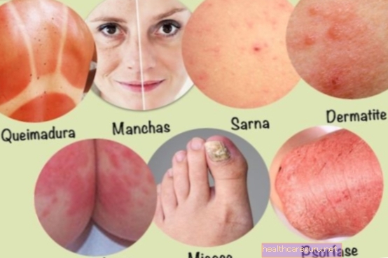 Salver for de 7 vanligste hudproblemene