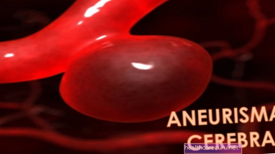 Aivojen aneurysma: mikä se on, oireet, syyt ja hoito