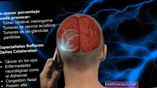 Симптоми тумора на мозгу