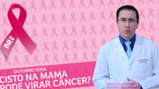 乳嚢胞は癌に変わることができますか？
