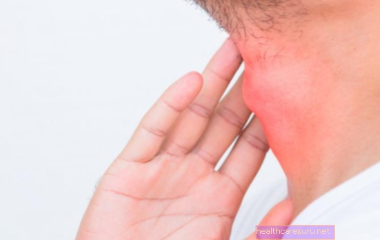 Основни симптоми на гуша, причини и лечение