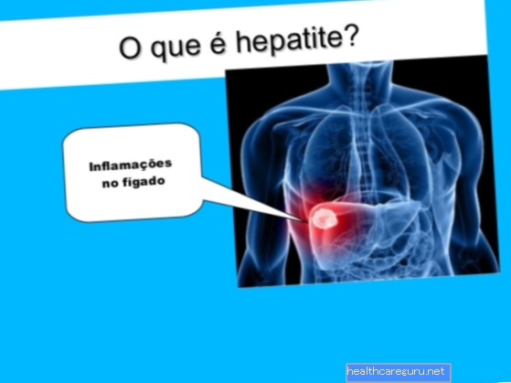 A-hepatiit: mis see on, sümptomid, edasikandumine ja ravi