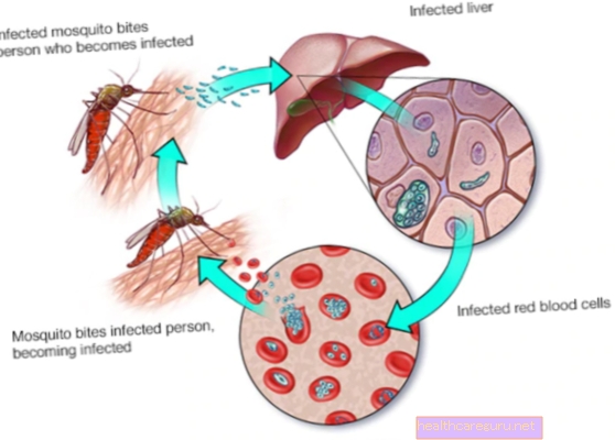 מלריה: מה זה, מחזור, העברה וטיפול