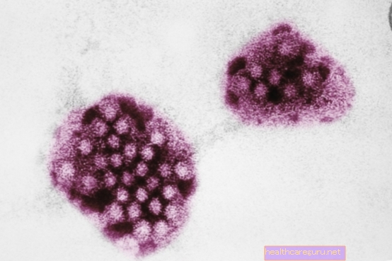 Norovirus: apa itu, gejala dan rawatan