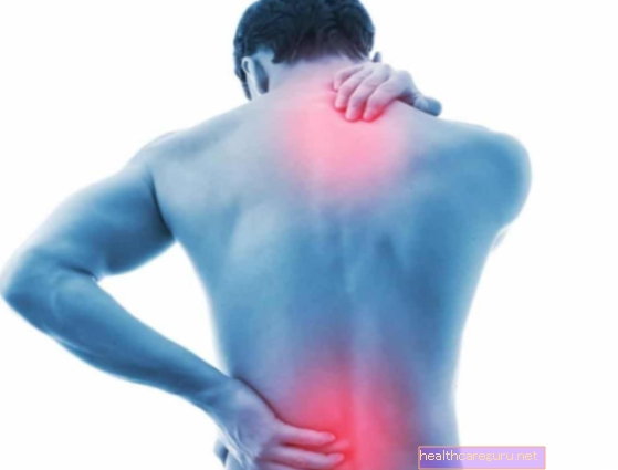 Bolečine v hrbtu lahko povzroča slaba drža