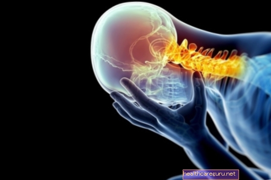 מהו spondyloarthrosis צוואר הרחם וכיצד לטפל
