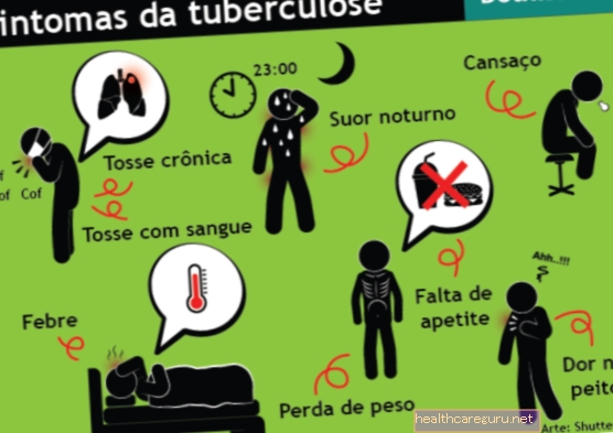 Gejala Tuberkulosis pada Tulang, penularan dan rawatan