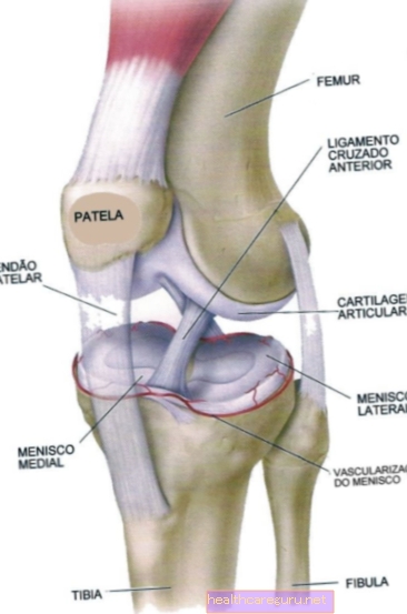 Тендинит в коляното (пателарен): симптоми и лечение