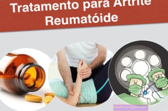 Reumatoidinio artrito gydymas