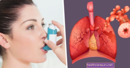 Astminis bronchitas: kas tai yra, simptomai ir gydymas