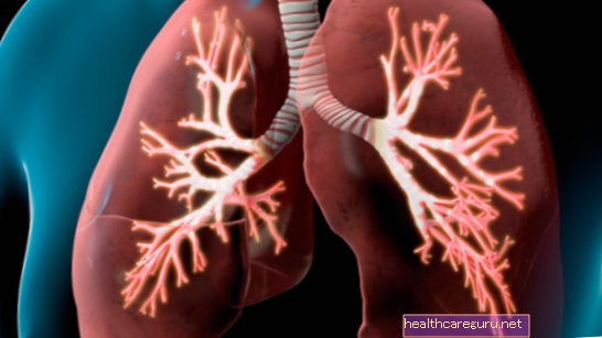 Pulmoner amfizem nasıl belirlenir, önleme ve tedavi