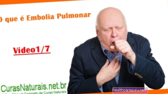 Plaučių embolija: kas tai yra, pagrindiniai simptomai ir priežastys