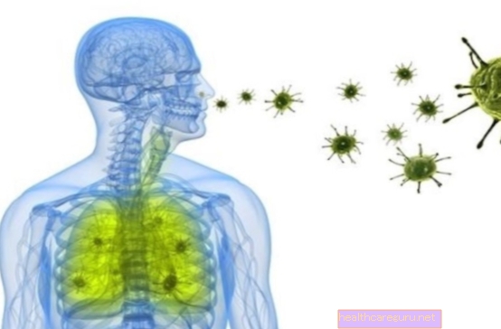 Pneumonie bactérienne: symptômes, transmission et traitement