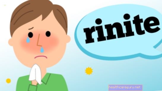 Rhinitt: hva det er, hovedsymptomer og behandling