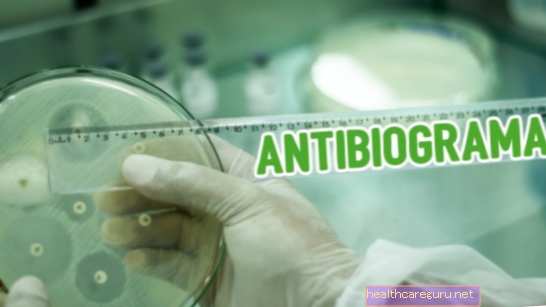 Antibiogram: kako se to radi i kako razumjeti rezultat
