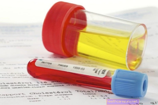 EAS test urina: čemu služi, priprema i rezultati