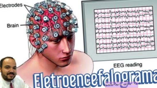 Mire való az elektroencefalogram és hogyan kell elkészíteni