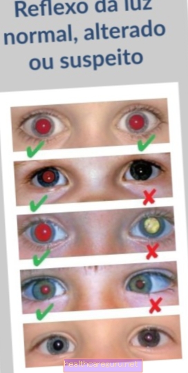 اختبار العين: ما هو ، ما الغرض منه وكيف يتم إجراؤه