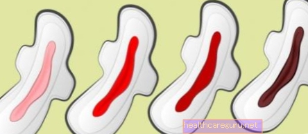 Mørk menstruasjon: 6 årsaker og når du skal bekymre deg