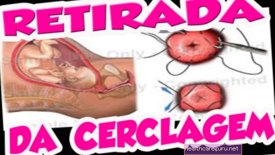 Uterine cerclage: Hva er kirurgi og hvordan utføres det for å holde babyen
