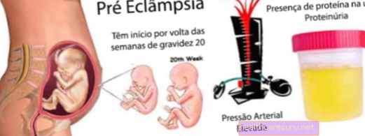 Eclampsia ในครรภ์: มันคืออะไรอาการหลักและการรักษา